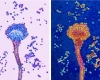 Diseases associated with fungi...a growing threat that expands around the world