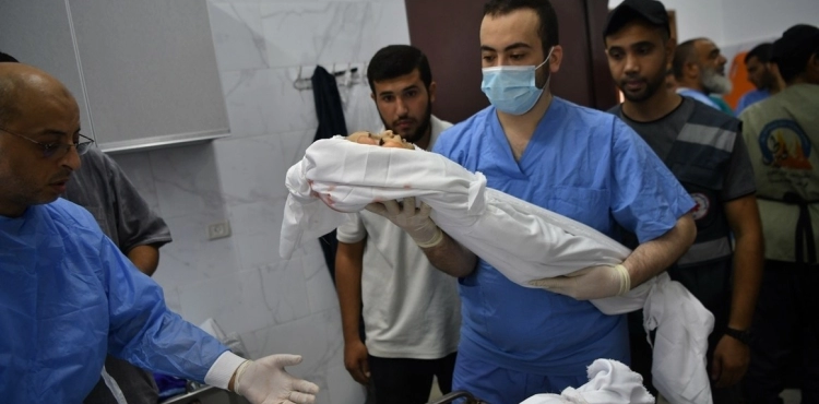 The occupation kills 100 children every day in Gaza!