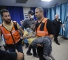 Gaza doctors work in complex conditions to treat burn patients