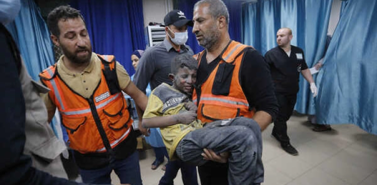 Gaza doctors work in complex conditions to treat burn patients