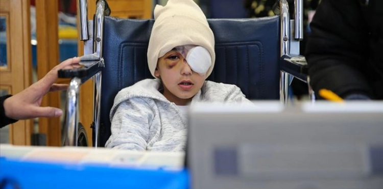 Jerusalem .. Doctors decide to remove the eye of a Palestinian child who was shot by an Israeli bullet
