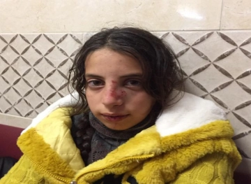 A child was wounded during a settler attack on Madama village, south of Nablus