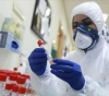 The Palestinian Ministry of Health records two deaths and 292 new cases of â€œCoronaâ€