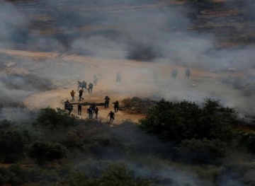 Shot injury during confrontations with the occupation on Jabal Sobeih