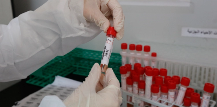3 deaths, 862 new infections with the â€œCoronaâ€ virus, and 144 recoveries