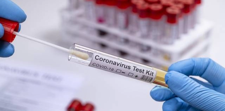 Deaths, 71 new cases of corona and 62 recoveries