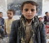 UNICEF: 66, 000 Yemeni children die of preventable diseases annually