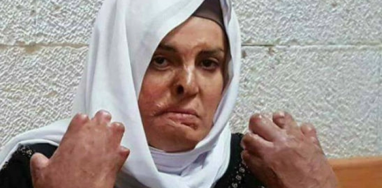 Prisoner Al-Jabbais undergoes difficult medical conditions