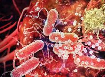 Researchers expect a sweeping wave of cancerous diseases worldwide