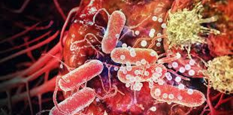Researchers expect a sweeping wave of cancerous diseases worldwide