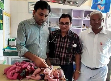 An Indian gives birth to a baby girl with four legs and three arms.
