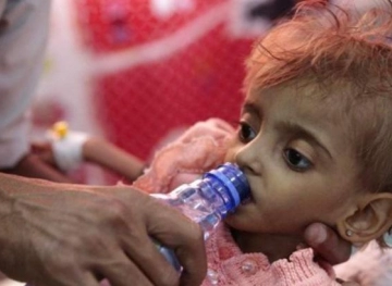 257 Yemenis die of diphtheria epidemic in nearly two years
