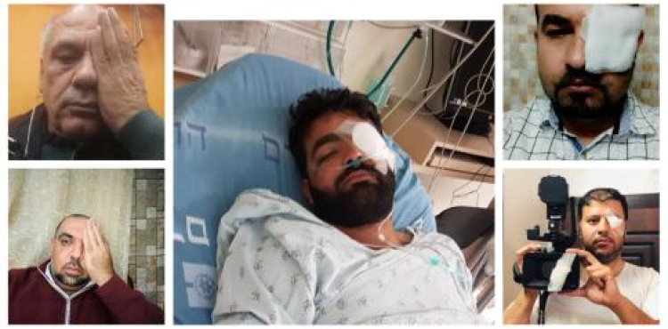 An online campaign to support journalist Moaz Amarna: &quot;Eye Moaz&quot;. &quot;Eye of Truth&quot;