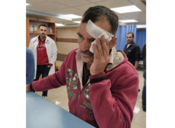 A farmer injured by settlers during an olive harvest