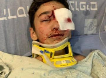 A child was wounded by the Israeli occupation forces