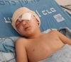 Easa childÂ´s eye removed after several attempts to treat it