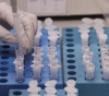 Gaza: 33 laboratory tests for suspected Corona. The results are sound.
