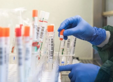 The number of people recovering from the Corona virus in Kuwait increased to 93 cases