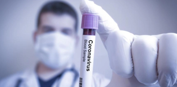 47 corona deaths in Israel
