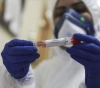 Updated 8 new cases of coronavirus were recorded, and today the toll rises to 73