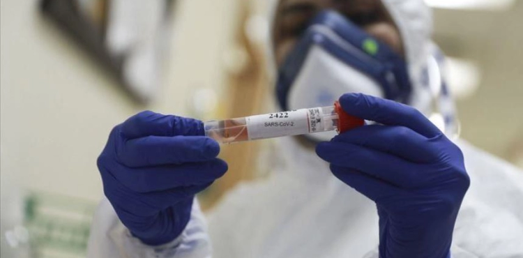 Updated 8 new cases of coronavirus were recorded, and today the toll rises to 73