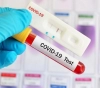 20 new infections were recorded in Corona, Hebron, Ramallah and Al-Bireh