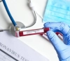 Health: 330 new cases of coronavirus