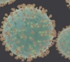 A citizen died of his infection with Corona, and the total rose to 132
