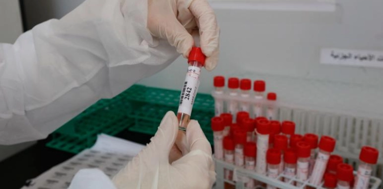 Gaza health expects 300 cases of corona every day