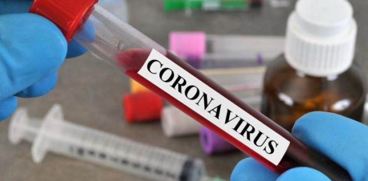 7 deaths and 420 new cases of &quot;Corona&quot; virus during the last 24 hours