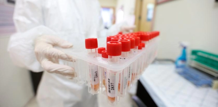 Health: 11 deaths and 491 new cases of Corona