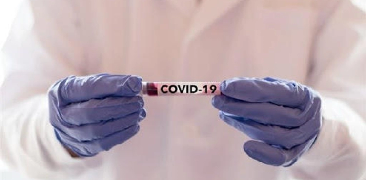9 deaths and more than 1,550 new cases of Corona