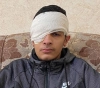 Report | Israeli soldiers deliberately inflicted permanent disabilities on children during confrontations