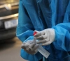 15 deaths, 797 new infections, and 1,441 recoveries