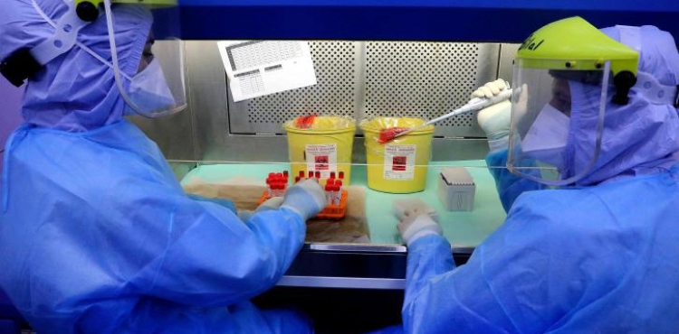 21 deaths and 1,851 new cases of corona