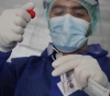 Health: 33 deaths and 2,418 new cases of corona