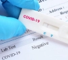 Health: 12 deaths, 559 new cases of corona, and 2,148 recoveries