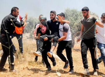 Two young men were injured by the occupation bullets, and dozens suffocated during clashes in Beita