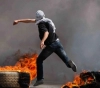 Shot injuries during the occupation suppression of activities in the West Bank