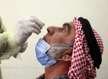 Ministry of Health: 36 new cases of corona and 1482 recoveries