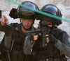 Hebron: Amputation of a foot injured by Israeli bullets after two years