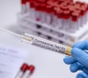 During the past 24 hours ... 66 cases of Corona virus were recorded in Gaza