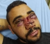 Louay Abu Zaitoun.. The occupation disfigured his face and damaged the cornea of â€‹â€‹his eye when he was arrested