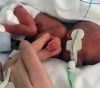 In pictures | A child born in the size of a bean can celebrate his first birthday